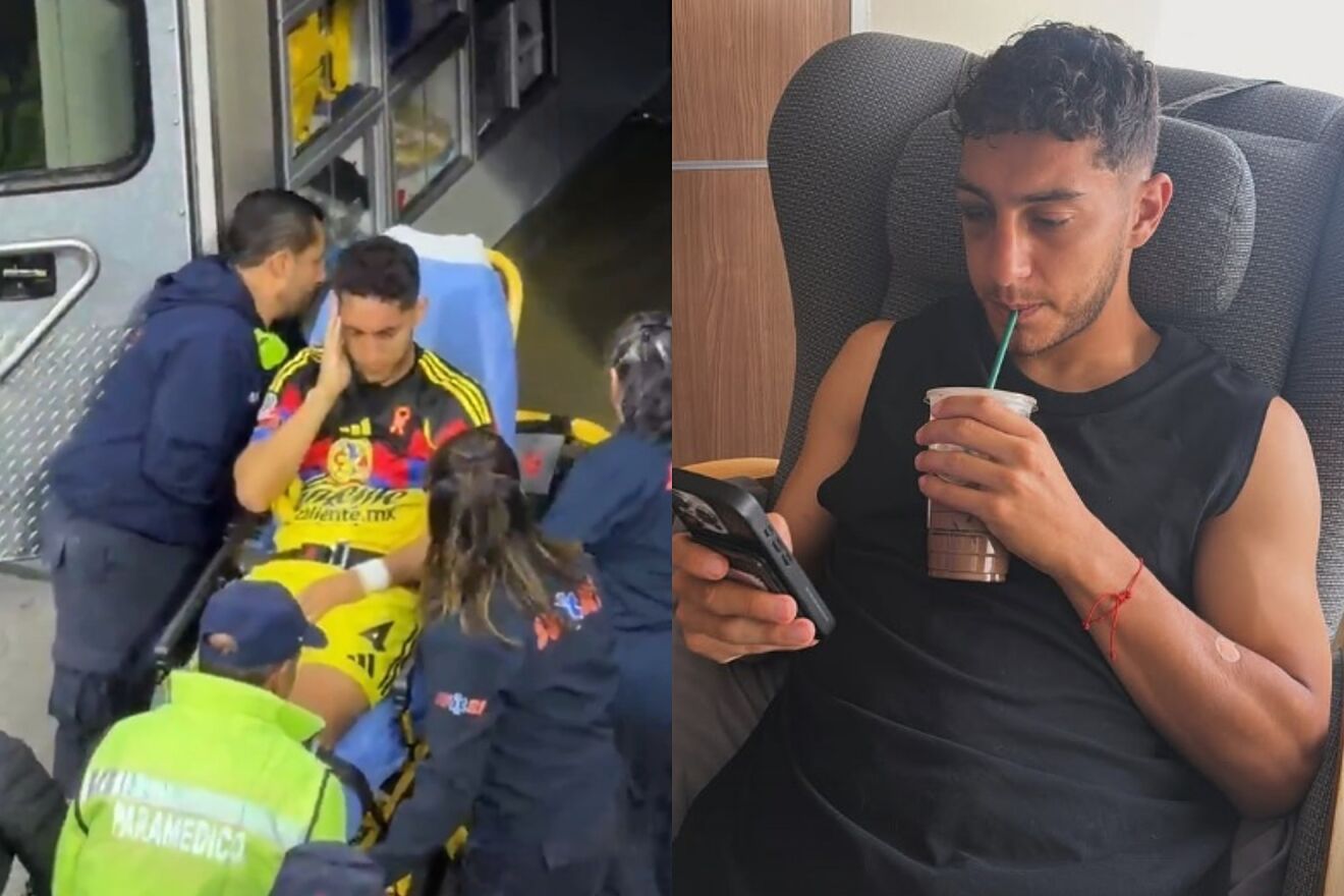 Liga MX 2026: Como boxeador: Alana Flores revela cómo queda el rostro ...