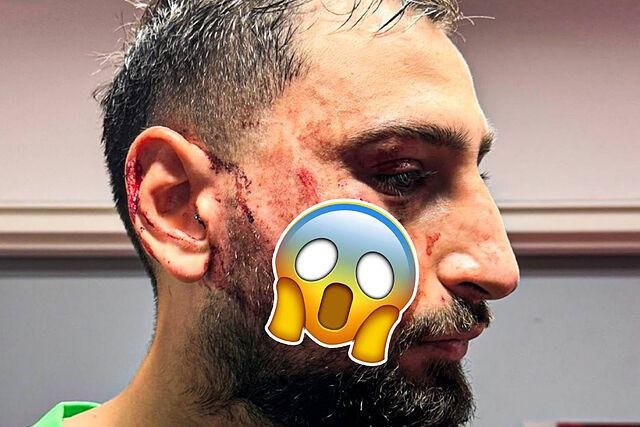 Fuerte impacto el recibido por el arquero italiano en una entrada ruda y dividida