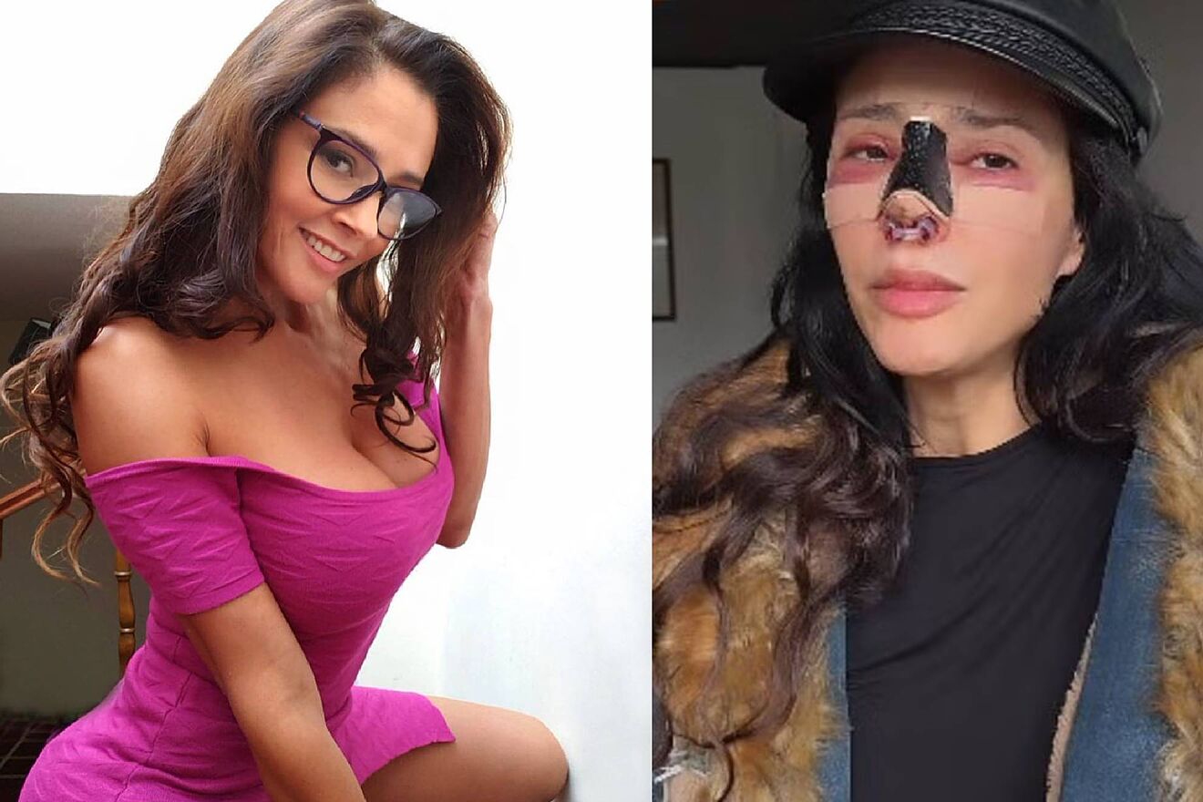 La modelo argentina Dorismar reaparece con cara desfigurada tras mala...