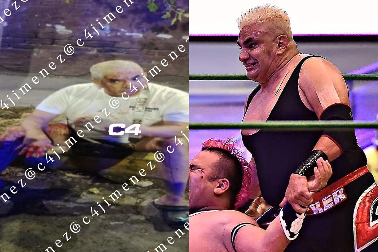 Shocker se corta la mano en discusi�n de la esposa